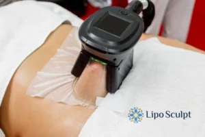 Cryolipolysis Helping You Getting that Perfect Summer Body 3 Cryolipolysis Chesham can give you the best summer body - contact us today!