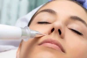 Best Actinic Keratoses Removal 3 Actinic keratoses Chesham solutions - book in today!